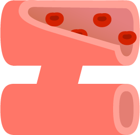 血管図